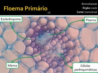 Parênquima depreenchimento 
Feixe 
Vascular 
400x 
Bromeliaceae 
Órgão:caule 
Corte:transversal 
Floema 
Células 
parênquimáticas 
Xilema 
Esclerênquima 
(2)  