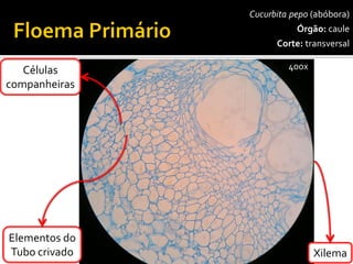 Cucurbita pepo(abóbora) 
Órgão:caule 
Corte:transversal 
Xilema 
400x 
Elementos do 
Tubo crivado 
Células 
companheiras  