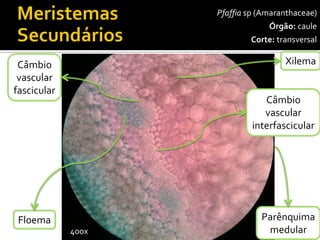 Pfaffiasp(Amaranthaceae) 
Órgão:caule 
Corte:transversal 
Xilema 
400x 
Floema 
Câmbio 
vascularfascicular 
Parênquima 
medular 
Câmbio 
vascularinterfascicular  
