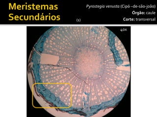 40x 
Pyrostegiavenusta(Cipó –de-são-joão) 
Órgão:caule 
Corte:transversal 
(1)  