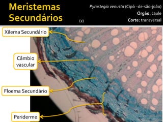 40x 
Pyrostegiavenusta(Cipó –de-são-joão) 
Órgão:caule 
Corte:transversal 
Xilema Secundário 
Periderme 
Câmbiovascular 
Floema Secundário 
(2)  