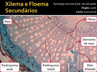 Parênquima 
axial 
Raio 
Raio 
dilatado 
Fibras 
Elemento 
de vaso 
Pyrostegia venusta (Cipó –de-são-joão) 
Órgão:caule 
Corte:transversal 
Parênquima 
radial  
