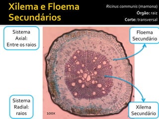 Ricinuscommunis(mamona) 
Órgão:raiz 
Corte:transversal 
Xilema 
Secundário 
100x 
Sistema 
Radial: 
raios 
Sistema 
Axial: 
Entre os raios 
Floema 
Secundário  