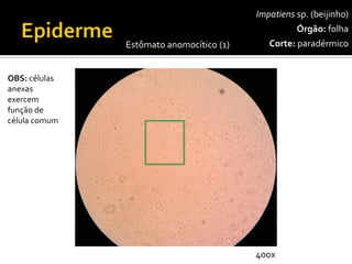 Impatienssp.(beijinho) 
Órgão:folha 
Corte:paradérmico 
OBS: células anexas exercem função de célula comum 
Estômato anomocítico(1) 
400x  