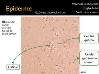 Impatienssp.(beijinho) 
Órgão:folha 
Corte:paradérmico 
Células guarda 
Célula epidérmica comum 
Ostíolo 
OBS: células anexas exercem função de célula comum 
Estômato anomocítico(2) 
400x  