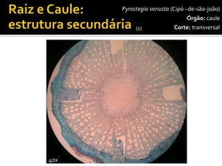 40x 
Pyrostegiavenusta(Cipó –de-são-joão) 
Órgão:caule 
Corte:transversal 
(1)  