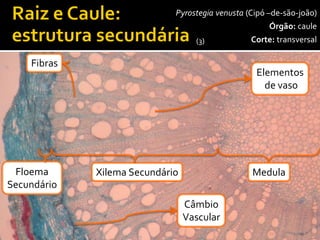 40x 
Câmbio 
Vascular 
Pyrostegia venusta (Cipó –de-são-joão) 
Órgão:caule 
Corte:transversal 
Floema 
Secundário 
Xilema Secundário 
Medula 
Fibras 
Elementos 
de vaso 
(3)  