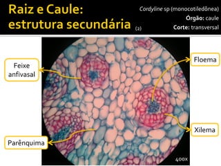 Cordylinesp(monocotiledônea) 
Órgão:caule 
Corte:transversal 
Floema 
400x 
Feixe 
anfivasal 
Parênquima 
Xilema 
(2)  