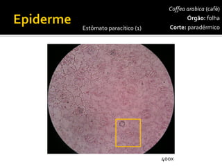 Coffeaarabica(café) 
Órgão:folha 
Corte:paradérmico 
Estômato paracítico(1) 
400x  