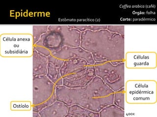 Coffeaarabica(café) 
Órgão:folha 
Corte:paradérmico 
Células guarda 
Célula epidérmica comum 
Ostíolo 
Célula anexaou subsidiária 
Estômato paracítico(2) 
400x  