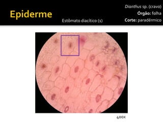 Dianthussp. (cravo) 
Órgão:folha 
Corte:paradérmico 
Estômato diacítico(1) 
400x  