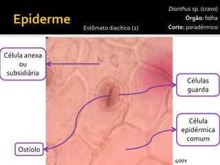Dianthussp. (cravo) 
Órgão:folha 
Corte:paradérmico 
Células guarda 
Célula epidérmica comum 
Ostíolo 
Célula anexaou subsidiária 
Estômato diacítico(2) 
400x  