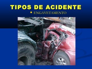 TIPOS DE ACIDENTE
       ENGAVETAMENTO
 