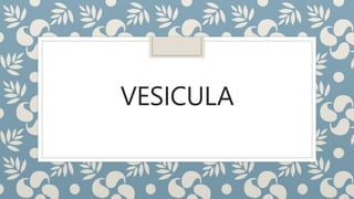 VESICULA
 