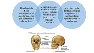 El techo de la
boca
corresponde al
maxilar superior,
que conforma el
paladar duro,
y suele presentar
malformaciones,
como el paladar
hendido, que
junto con los
incisivos
“centinela”
y la hipertrofia
del tejido linfoide
amigdalino son
eventualidades
que dificultan la
intubación.
 