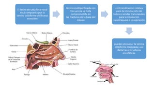 El techo de cada fosa nasal
está compuesta por la
lámina cribiforme del hueso
etmoides
lámina multiperforada con
frecuencia se halla
comprometida en
las fracturas de la base del
cráneo
contraindicación relativa
para la introducción de
tubos o sondas transnasales
para la intubación
nasotraqueal o la aspiración
pueden atravesar la lámina
cribiforme lesionada y así
dañar las estructuras
encefálicas.
 