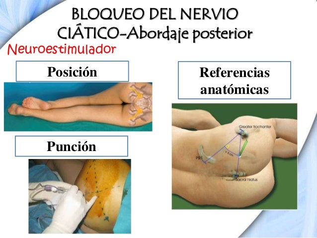 Anatomía y bloqueos de miembro inferior