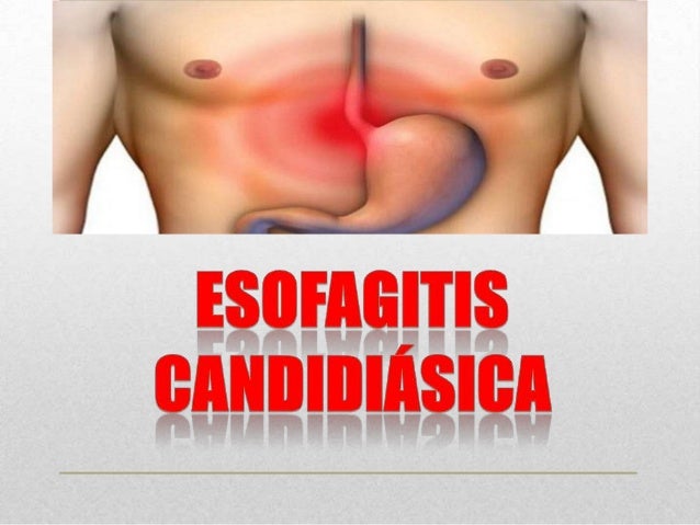 dolor agudo boca estomago y diarrea dolor agudo boca estomago y diarrea