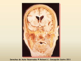 Derechos de Autor Reservados © Richard C. Concepción Castro 2011
 