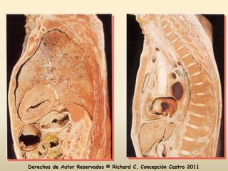 Derechos de Autor Reservados © Richard C. Concepción Castro 2011
 