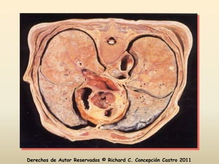 Derechos de Autor Reservados © Richard C. Concepción Castro 2011
 