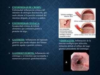  ENFERMEDAD DE CROHN;
Enfermedad inflamatoria crónica del
intestino de etiología desconocida, que
suele afectar al la por...