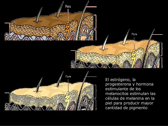 Se librará de las manchas seniles de pigmento en las manos