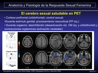 • Corteza prefrontal (orbitofrontal): control sexual.
•Durante estímulo genital: procesamiento neocortical (FP izq.)
• Dur...