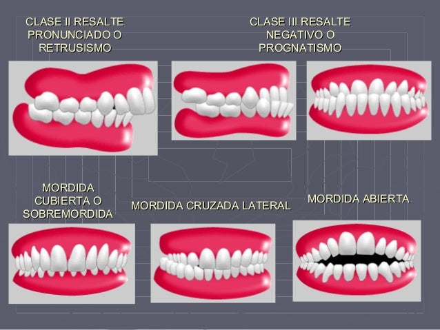 Anatomia y fisiologia Dental