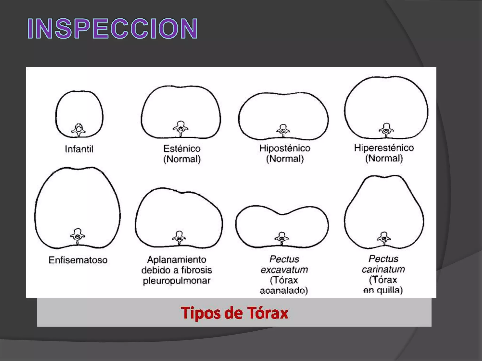 Anatomia y fisiologia pulmonar ok