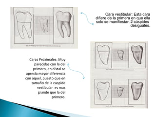 Cara vestibular: Esta cara
                             difiere de la primera en que ella
                             solo se manifiestan 2 cúspides
                                                  desiguales.




  Caras Proximales: Muy
      parecidas con la del
     primero, en distal se
aprecia mayor diferencia
con aquel, puesto que en
    tamaño de la cuspide
        vestibular es mas
        grande que la del
                 primero.
 