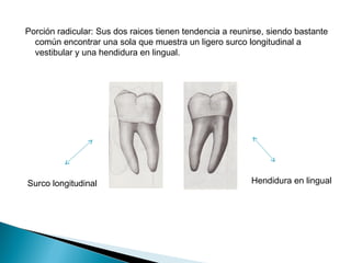 Porción radicular: Sus dos raices tienen tendencia a reunirse, siendo bastante
  común encontrar una sola que muestra un ligero surco longitudinal a
  vestibular y una hendidura en lingual.




Surco longitudinal                                        Hendidura en lingual
 