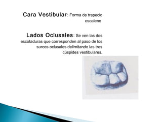 Cara Vestibular : Forma de trapecio
                                   escaleno


   Lados Oclusales : Se ven las dos
escotaduras que corresponden al paso de los
        surcos oclusales delimitando las tres
                      cúspides vestibulares.
 