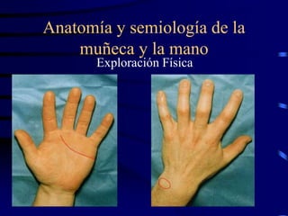 Anatomía y semiología de la
muñeca y la mano
Exploración Física
 