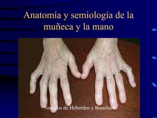 Anatomía y semiología de la
muñeca y la mano
Nodulos de Heberden y Bouchard
 