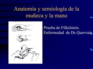 Anatomía y semiología de la
muñeca y la mano
Prueba de Filkelstein.
Enfermedad de De Quervain
 
