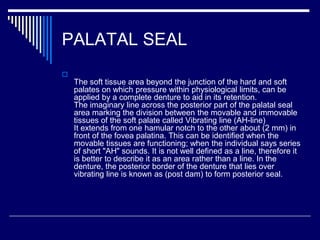 PALATAL SEAL

The soft tissue area beyond the junction of the hard and soft
palates on which pressure within physiological limits, can be
applied by a complete denture to aid in its retention.
The imaginary line across the posterior part of the palatal seal
area marking the division between the movable and immovable
tissues of the soft palate called Vibrating line (AH-line)
It extends from one hamular notch to the other about (2 mm) in
front of the fovea palatina. This can be identified when the
movable tissues are functioning; when the individual says series
of short "AH" sounds. It is not well defined as a line, therefore it
is better to describe it as an area rather than a line. In the
denture, the posterior border of the denture that lies over
vibrating line is known as (post dam) to form posterior seal.
 