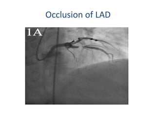 Anatomical basis of coronary intervention | PPTX