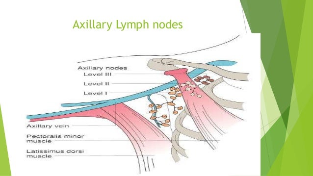 Anatomical basis of spread of breast carcinoma