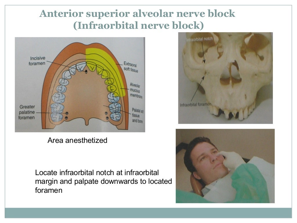 Anatomical correlation of local anesthesia in dentistry