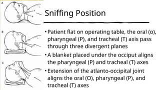Anatomical Differences Between Adult and Pediatric Airway and.pptx