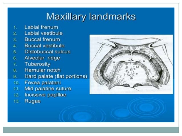 hamular notch