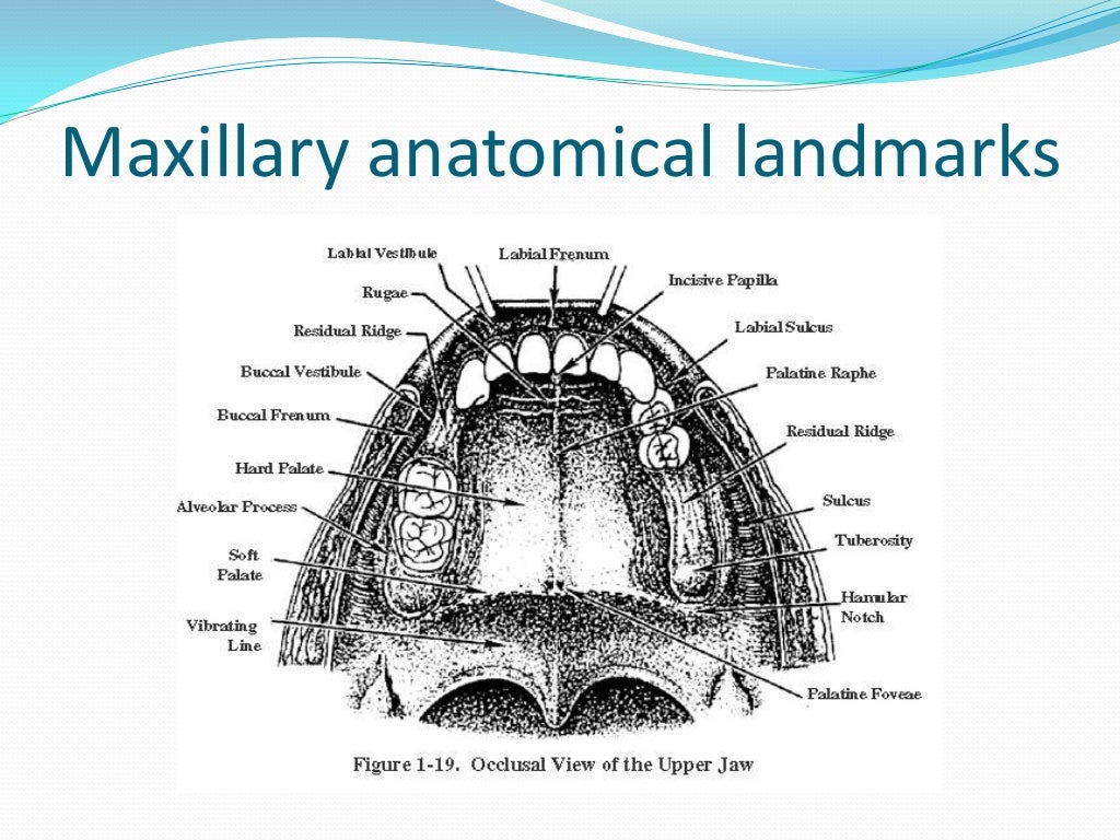 Anatomical Landmarks for Complete Dentures