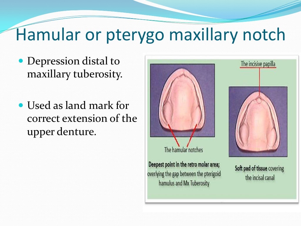 Anatomical Landmarks for Complete Dentures