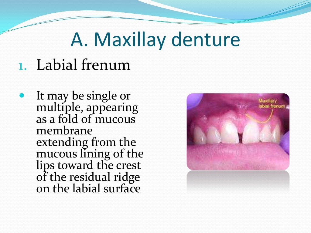 Anatomical Landmarks for Complete Dentures
