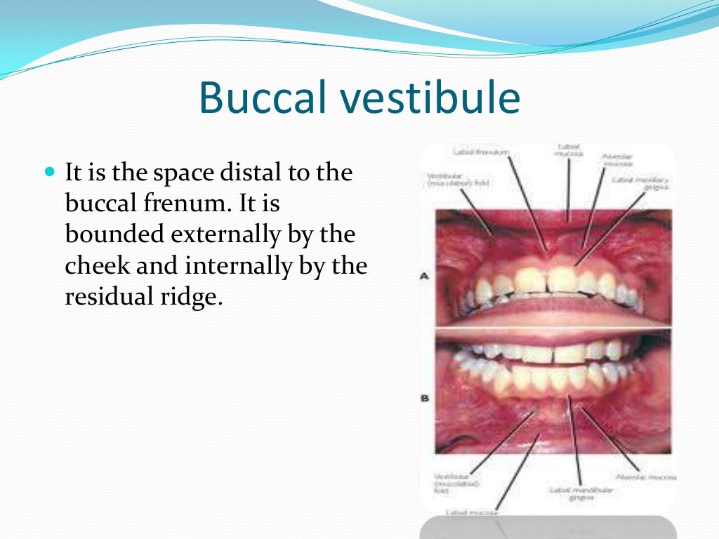 Anatomical Landmarks for Complete Dentures