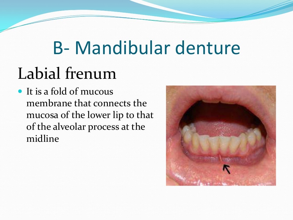 Anatomical Landmarks for Complete Dentures