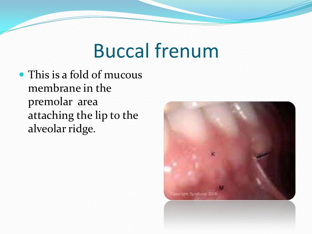 Anatomical Landmarks for Complete Dentures
