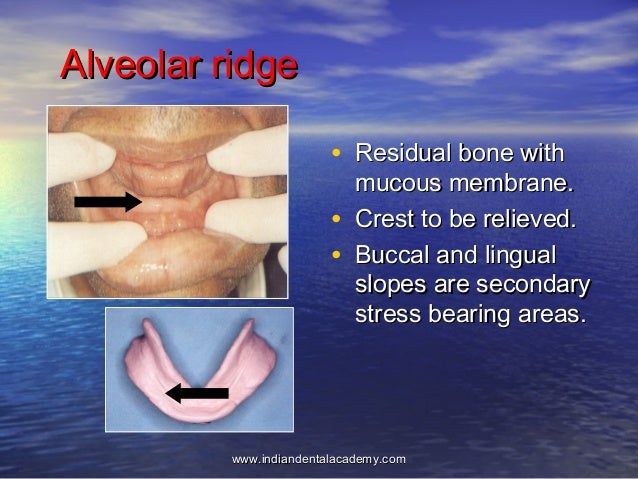 Anatomical landmarks/ dental implant courses by Indian dental academy