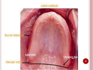 Anatomical landmarks of maxilla and mandible | PPTX